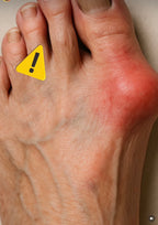 Zaawansowane skarpety uciskowe ze wsparciem, na haluksy, czarne Podoks